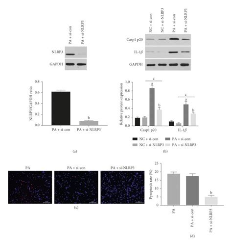 Downregulation Of Nlrp3 Inhibited Pyroptosis In Podocytes Under