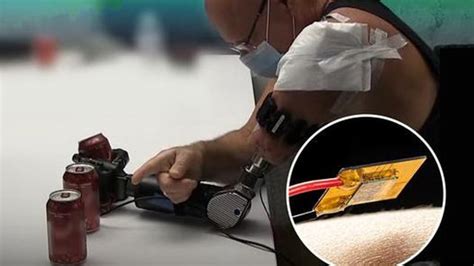 Scientists Restore Cold Sensation in Amputees’ Phantom Limbs ...
