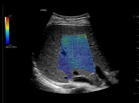 LOGIQ™ E10 Ultrasound | GE Healthcare