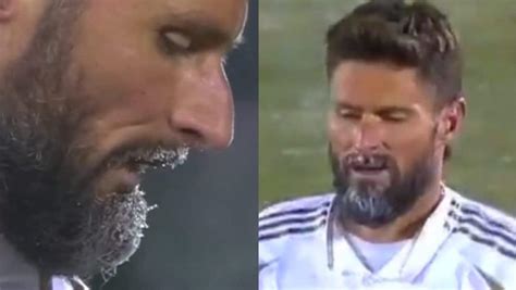 giroud finisce la partita  la barba congelata ha giocato