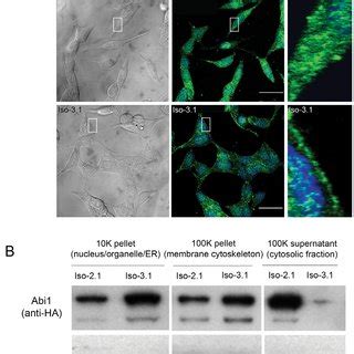 Differential Subcellular Localization Of Abi Isoforms A