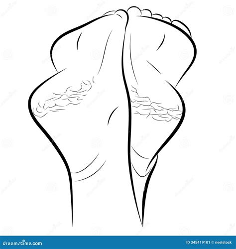 Cracked Dry Skin on Woman S Heels, Stock Vector - Illustration of pain