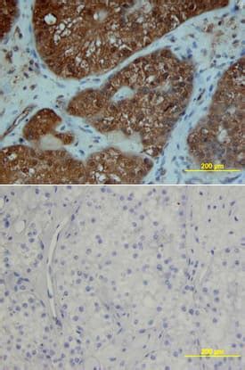 Human Pdgf R Alpha Antibody Af Na By R D Systems Part Of Bio Techne