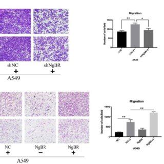 NgBR is required for TGF β1 induced cell migration and invasion of A549