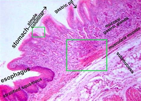 Esophagus Stomach Junction Histology Labeled 6600 The Best Porn Website