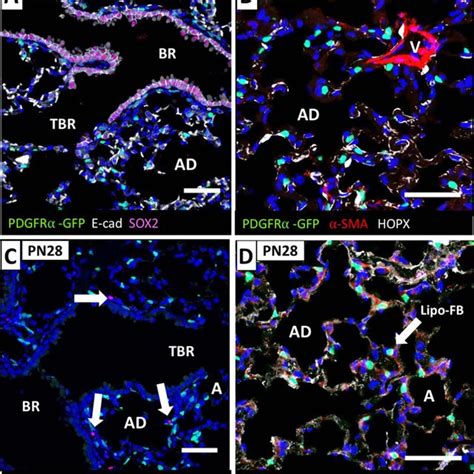 Immunophenotyping Of Pdgfrα Fibroblasts Across The Developmental