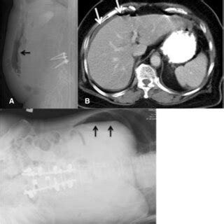 A B A 76 Year Old Female Complained Of Abrupt Onset Of Abdominal Pain