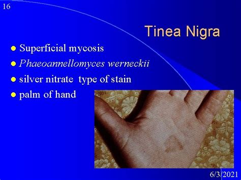 1 Medical Mycology Superficial Cutaneous And Subcutaneous Mycoses