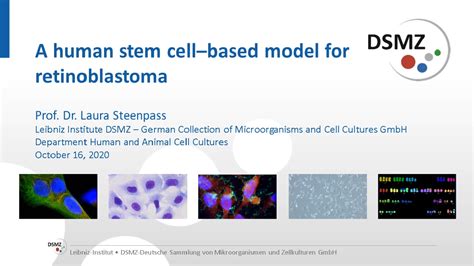 A Human Stem Cell Based Model For Retinoblastoma Scientific Videos