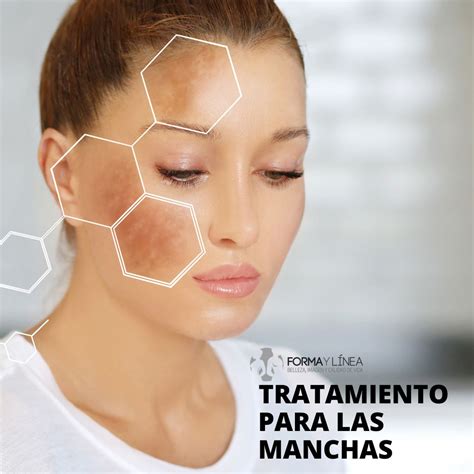 CUÁL ES EL MEJOR TRATAMIENTO PARA LAS MANCHAS