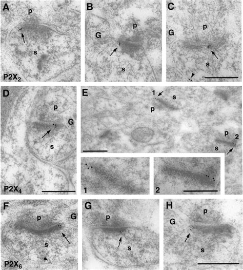 Electron Micrographs Showing Postembedding Immunogold Labeling For P2x