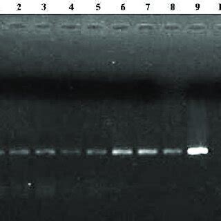 Electrophoresis In Agarose Gel Stained With Ethidium Bromide Where