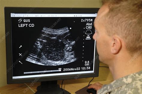 Dolphin ultrasound - Stock Image - M980/0191 - Science Photo Library