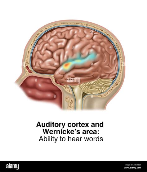 Auditory Cortex Mri