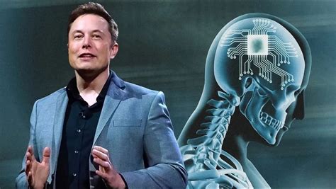 Neuralink Installa Il Primo Chip Nel Cervello Di Un Uomo Risultati