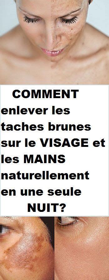 COMMENT Enlever Les Taches Brunes Sur Le VISAGE Et Les MAINS