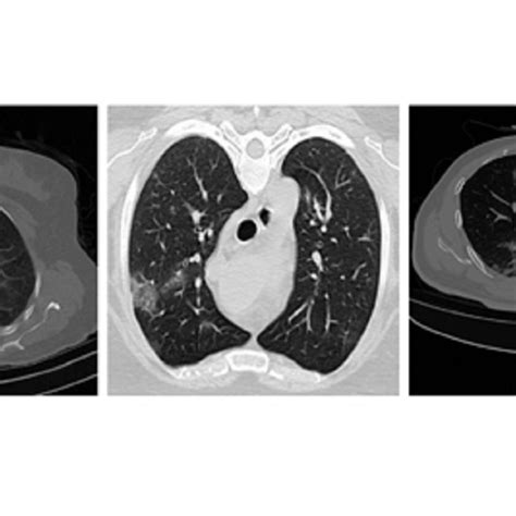 Large COVID-19 CT scan slice dataset | Kaggle