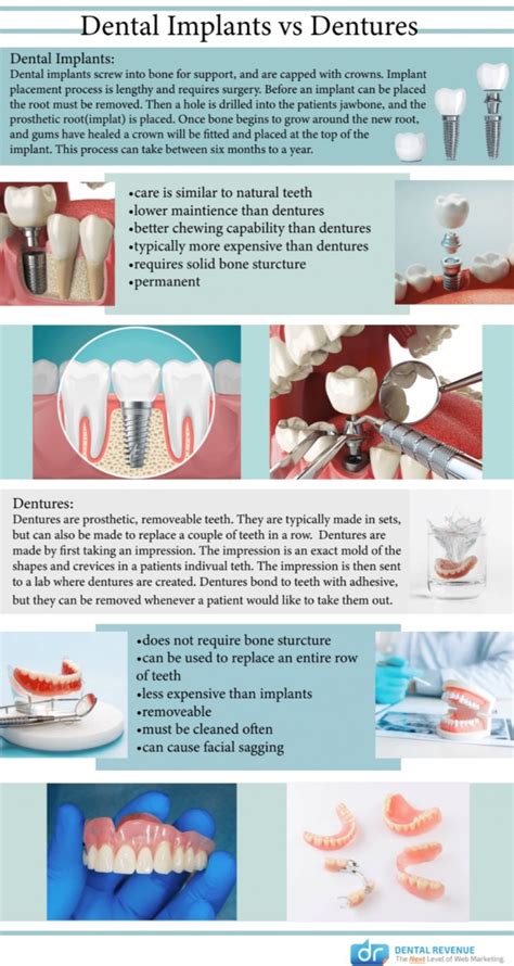 Dental Implants Vs Dentures Cosmetic Advanced Dentistry