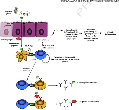 Figure 2 From Human Leukocyte Antigen Hla Dq2dq8 Prevalence In