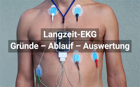 Ekg Anlegen Elektrokardiographie Praxis Witzhelden Das Ekg