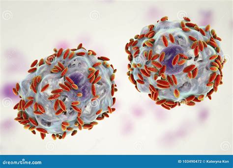 Microscopic Diagnosis Of Bacterial Vaginosis Epithelial Cell So Called Clue Cell Is Covered