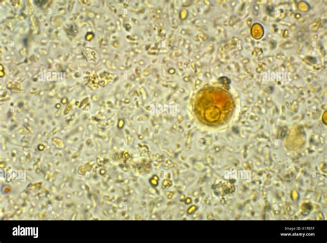 This Photomicrograph Depicts A Cyst Of An Entamoeba Histolytica Amoebic Parasite Displaying A