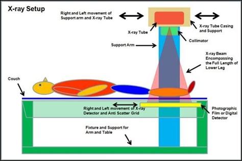 Drawing Of An X Ray Tube And Collimator Schematic