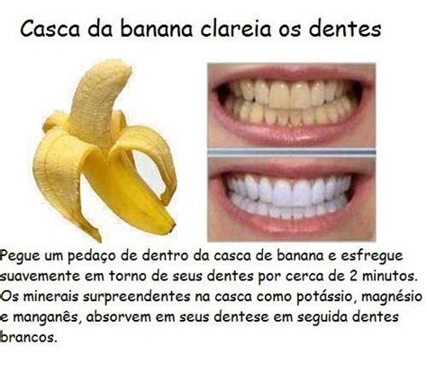 Mentira Casca De Banana N O Clareia Os Dentes Estimulanet