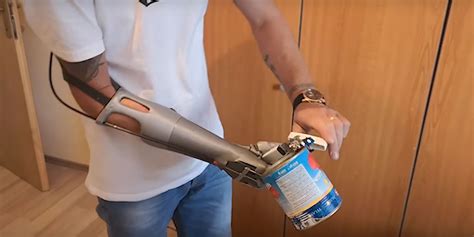 D Printed Prosthetic Arm