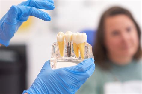 Understanding Dental Implants A Permanent Solution To Missing Teeth