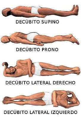 O Que Significa Decúbito - Decúbito Izquierdo Y Derecho , Decúbito lateral izquierdo: indicaciones ...