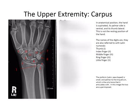 Week Radiology Of The Carpus Diagram Quizlet