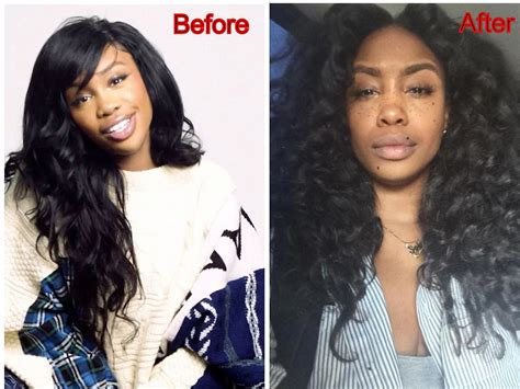 Sza Before Plastic Surgery Astonishing Look 2024