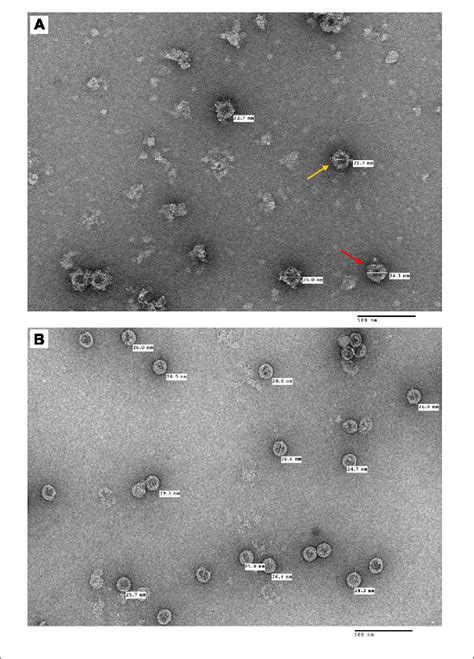 Electron Micrographs Showing The Purified Tandem Core Thbcag Cediii