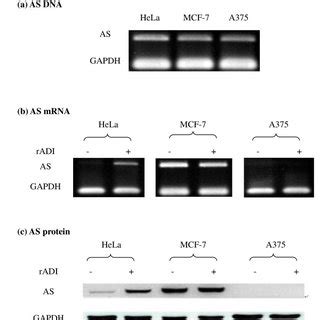 As Dna Mrna And Protein Expression In Hela Mcf And A Cells