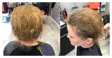 Palha Em Vez De Cabelo O Adolescente Que Tinha Medo De Cabeleireiros