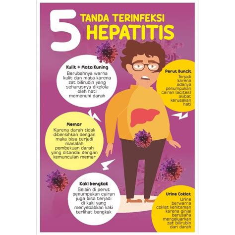 Jual Poster 5 Tanda Terinfeksi Hepatitis Shopee Indonesia