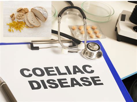 An overview of Coeliac Disease - Christel Lyell Dietitian