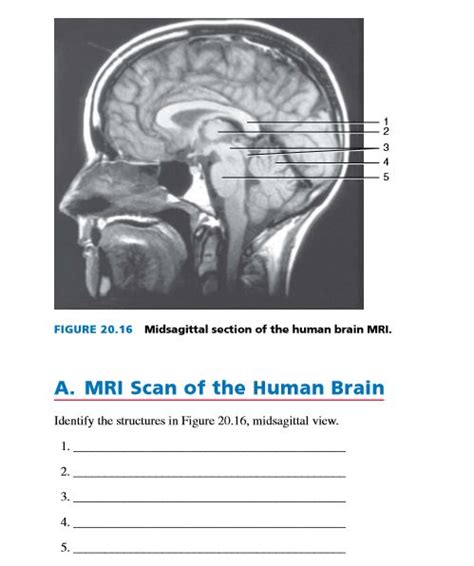 Answered: FIGURE 20.16 Midsagittal section of the… | bartleby