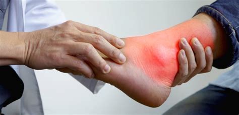 Ankle Arthritis Symptoms | Voltaren