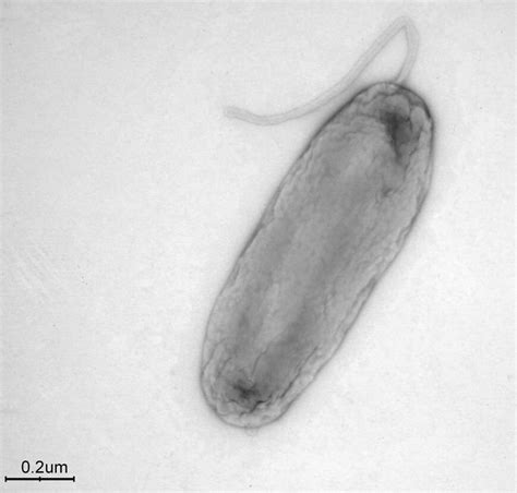 Legionella Bononiensis A New Legionella Species Has Been Identified