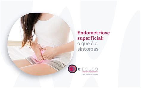 Endometriose superficial o que é e sintomas