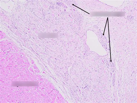 Histo Cardio Diagram Quizlet