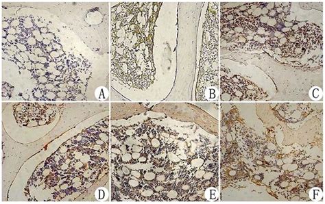 Immunohistochemical Staining Of VEGF In The Femoral Heads From Each