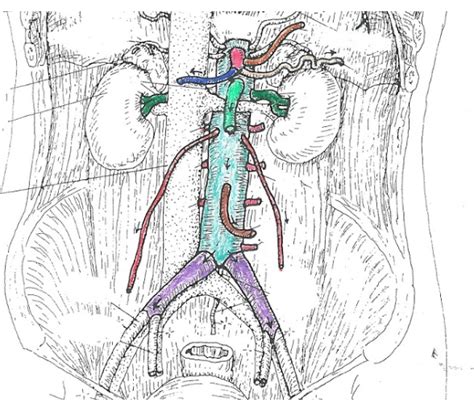 Inferior Thoracic Abdominal Arteries Diagram Quizlet