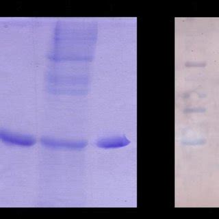 12 SDS PAGE And Western Blot Analysis Of Purified R CGH A Lane 1