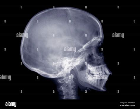 Human skull side view hi-res stock photography and images - Alamy