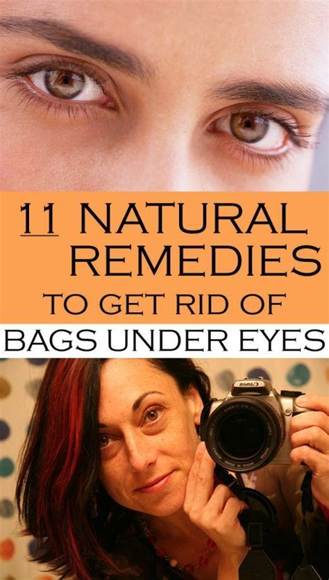 11 Natural Remedies To Get Rid Of Bags Under Eyes Undereye Eye Bag Remedies Undereye Bags Remedy