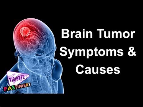 Brain Tumour: Symptoms, Causes and Treatment