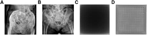 Examples Of Pelvis Images Used For The Vga And The Cdrad Experiment A